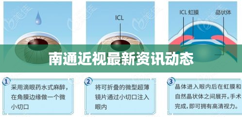 南通近视最新资讯动态